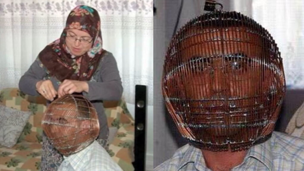 Ibrahim Yucel cage in head