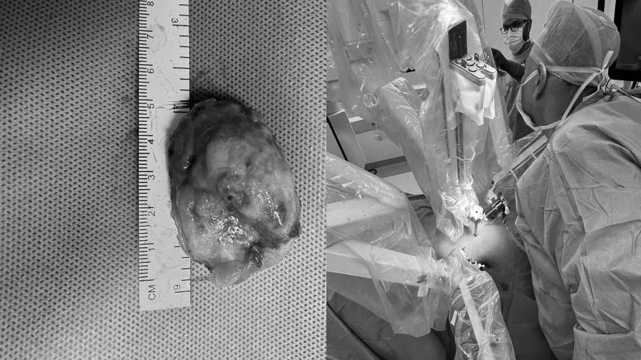 surgery