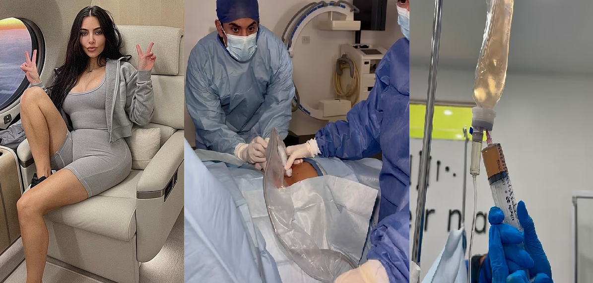 அமெரிக்காவில் கூட கிடைக்காத சிகிச்சை மெக்சிகோவில்.. கிம் கர்தாஷியனுக்கு அப்படி என்ன அறுவை சிகிச்சை? தொப்புள் கொடி ரத்தம் பயன்படுத்தப்பட்டதா?